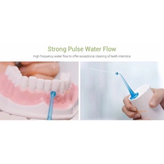 Bình 4 đầu xịt vệ sinh răng miệng Soocas W3