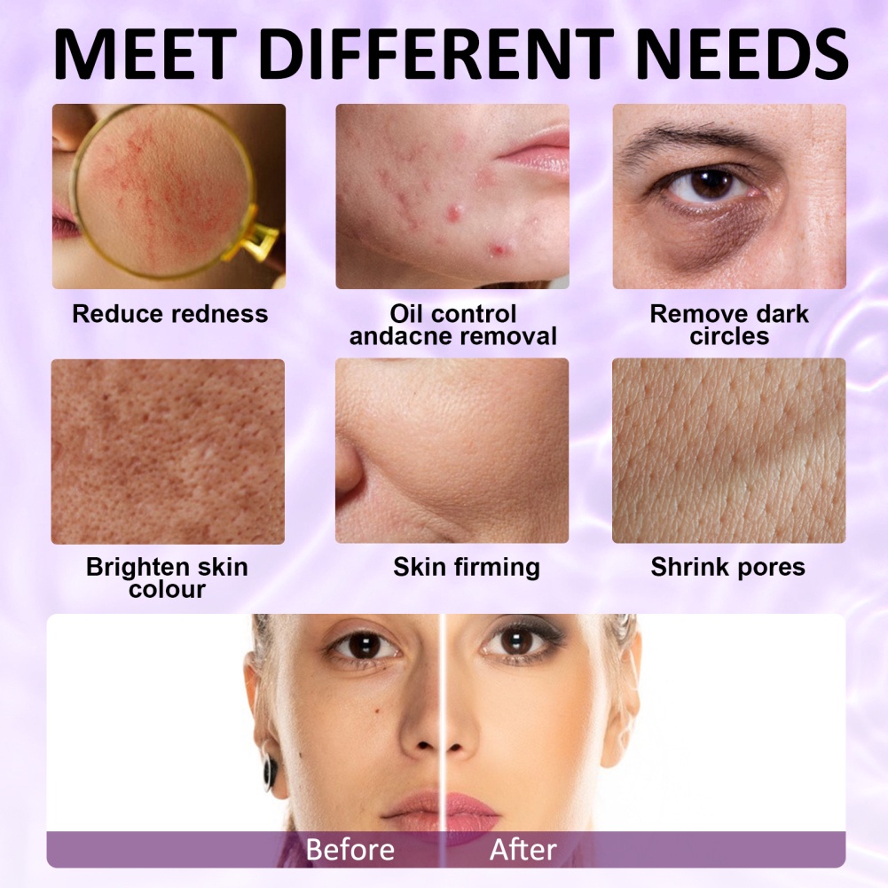 Cây Lăn Silicone Làm Đá Giảm Nếp Nhăn Có Thể Tái Sử Dụng (bốn màu) annies