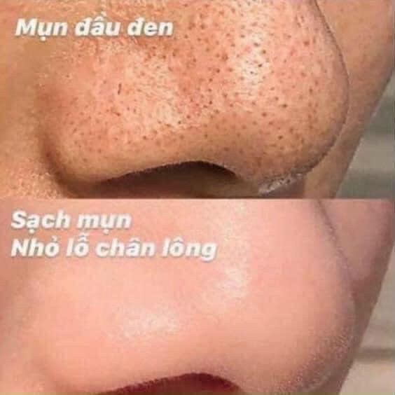 Mặt nạ đất sét Kiehls Rare Earth Deep Pore Cleansing Masque
