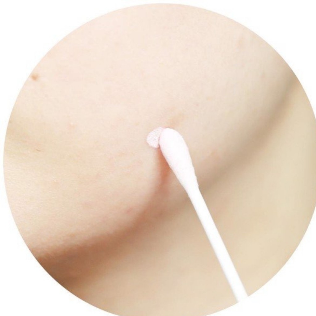 Chấm Mụn 2 Lớp Xẹp Mụn Sau 4H Neogen Dermalogy A-Clear Aid Soothing Pink Eraser 15ml | BigBuy360 - bigbuy360.vn