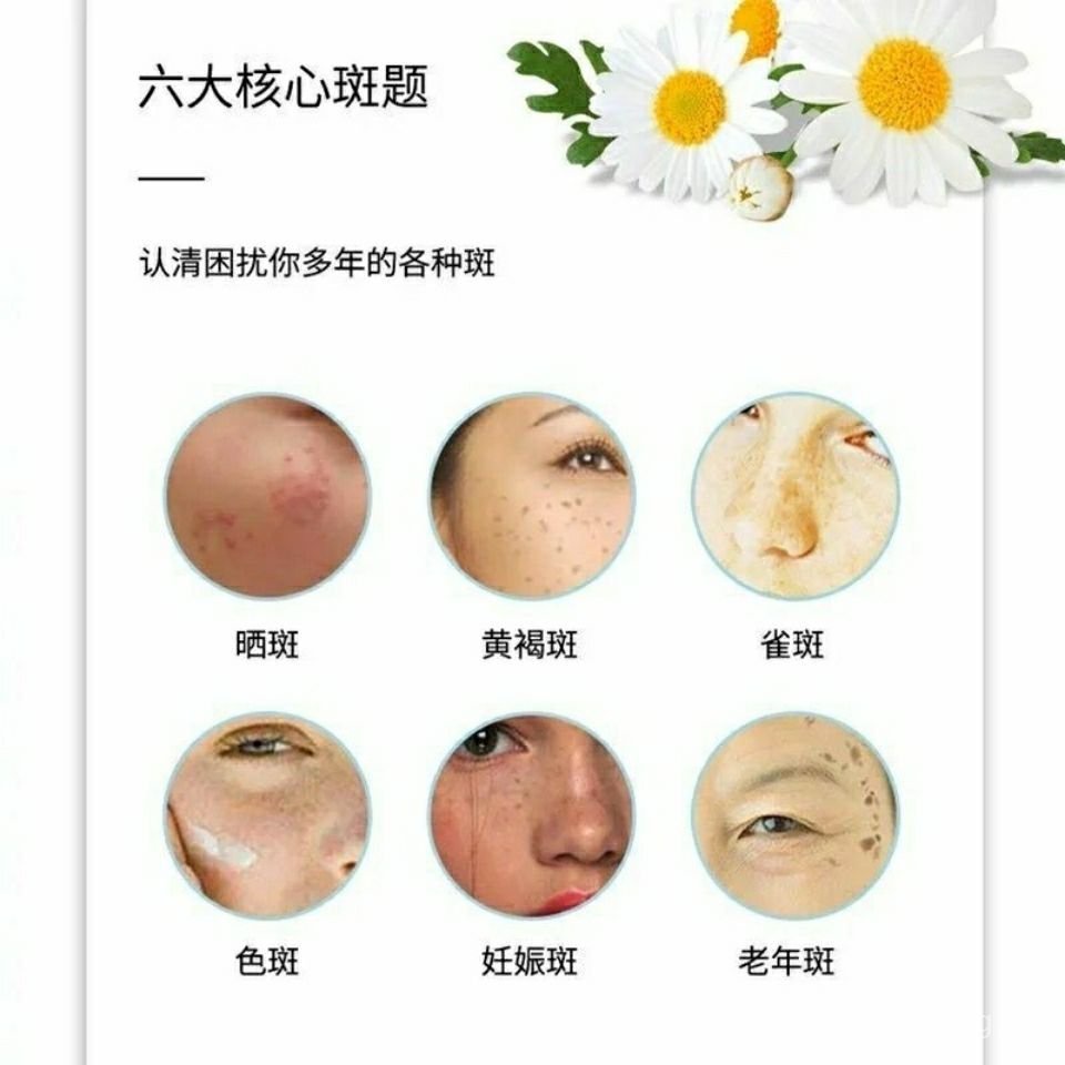Cải Thiện Nám Làn Da Đều Màu Da Chăm Sóc Da Với Tinh Chất Dưỡng