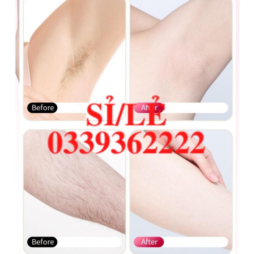 [ CHÍNH HÃNG ] Bộ dao cạo lông nách, bikini, lông chân 6 lưỡi tặng kèm 3 đầu thay Lady's Grainer Sena Beauty  HAIANHSHOP