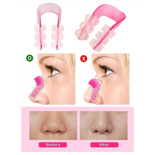 Dụng cụ nâng mũi/Kẹp Nâng Mũi Nose Up VW01 Vinhwatch