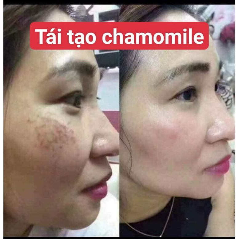 Kem tái tạo chamomile hồng sâm