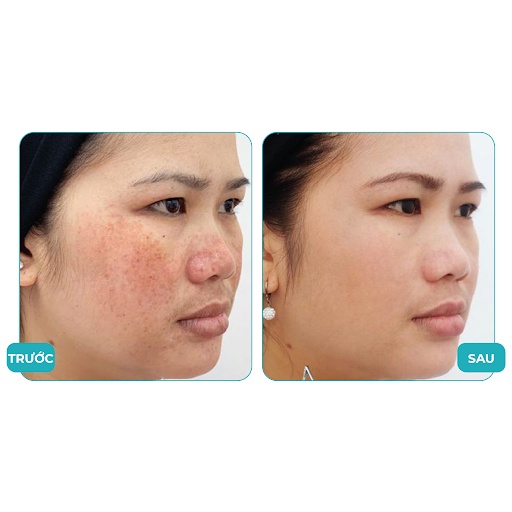 Kem Face Nhân Sâm N-Collagen Chính hãng hàng chuẩn