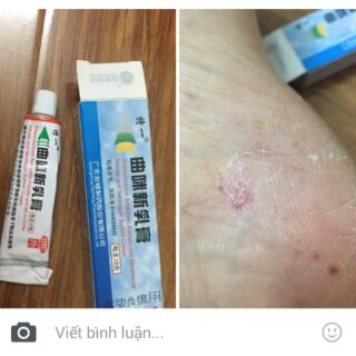 CB 10 LỌ TRỊ NẤM TỔ ĐỈA VIÊM DA