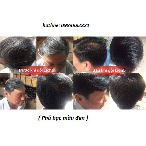 Dầu Gội Thảo Dược Đen Tóc Lich5 Hộp 10 gói | BigBuy360 - bigbuy360.vn