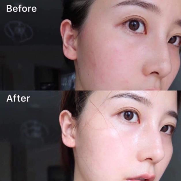 Toner Kiehl's Hoa Cúc Calendula Herbal Extract Alcohol