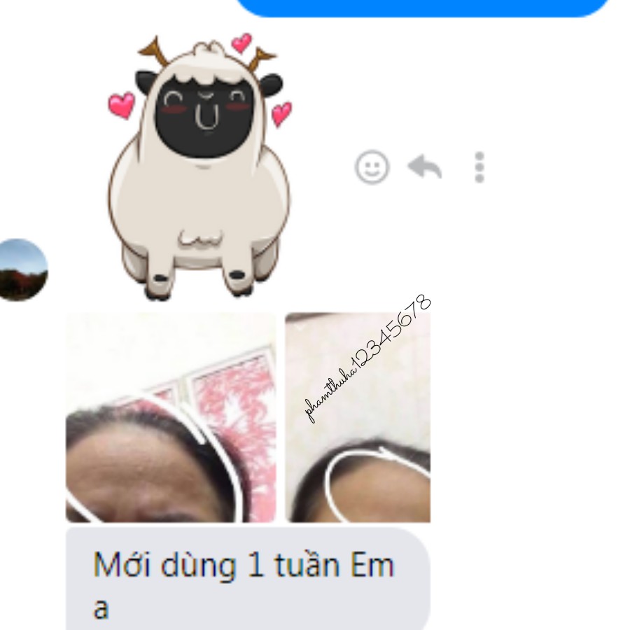 Collagen Dạng Nước Beauty Kollagen Mivolis