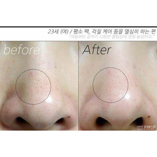 Mặt nạ đất sét Innisfree Super Volcanic Pore Clay Mask
