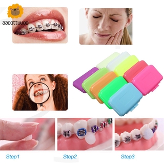 Dụng cụ bảo vệ góc miệng khi niềng răng