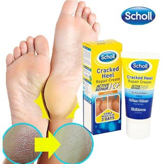 KEM TRỊ NỨT GÓT CHÂN SCHOLL