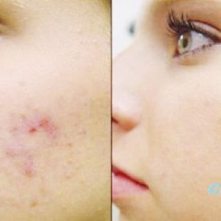 Kem dưỡng da CC melano Nhật Bản