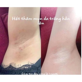 [CHÍNH HÃNG] Tinh chất Nuwhite H6 mờ thâm nách, bẹn, mông