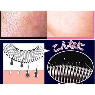 DỤNG CỤ TRIỆT LÔNG MÉP