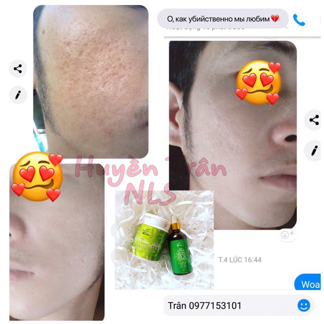 Ngọc Linh Sâm - Serum Thảo Mộc Cho Da Mụn Nám sẹo rỗ