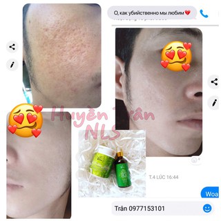 SERUM NGỌC LINH SÂM - BỘT RỬA MẶT [COMBO 2 HỘP]