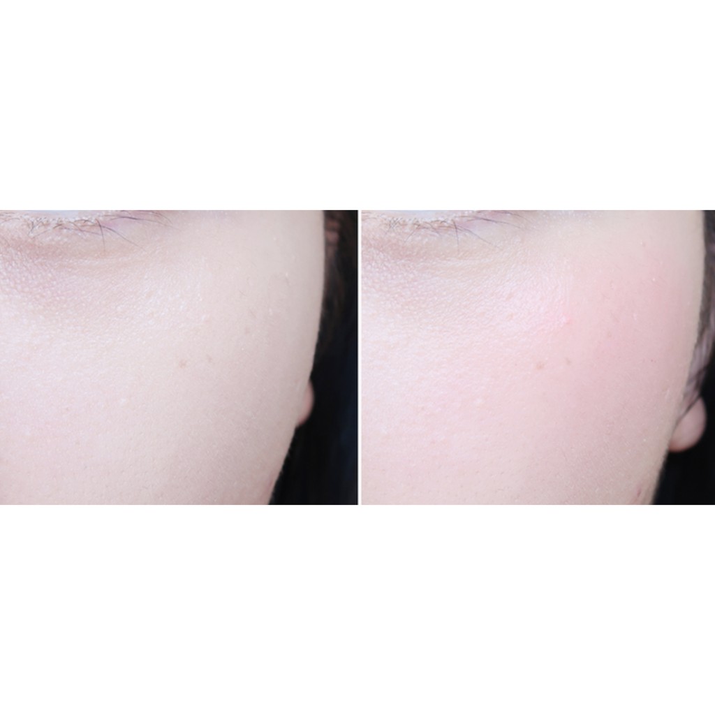 Kem bb cream miba 50ml | BigBuy360 - bigbuy360.vn