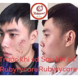 RUBYRYCARE