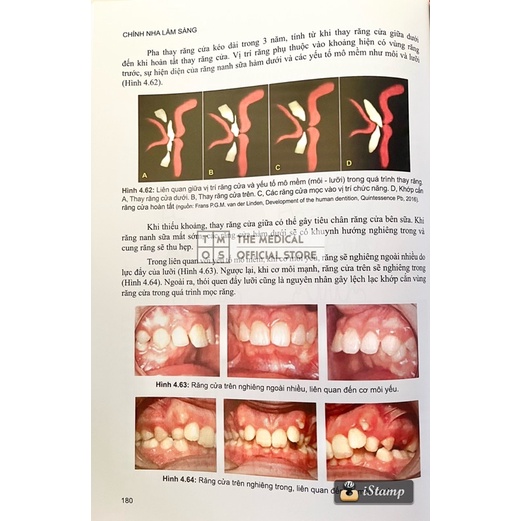 Sách - Chỉnh Nha Lâm Sàng Từ Nguyên Lý Đến Kỹ Thuật Tmos