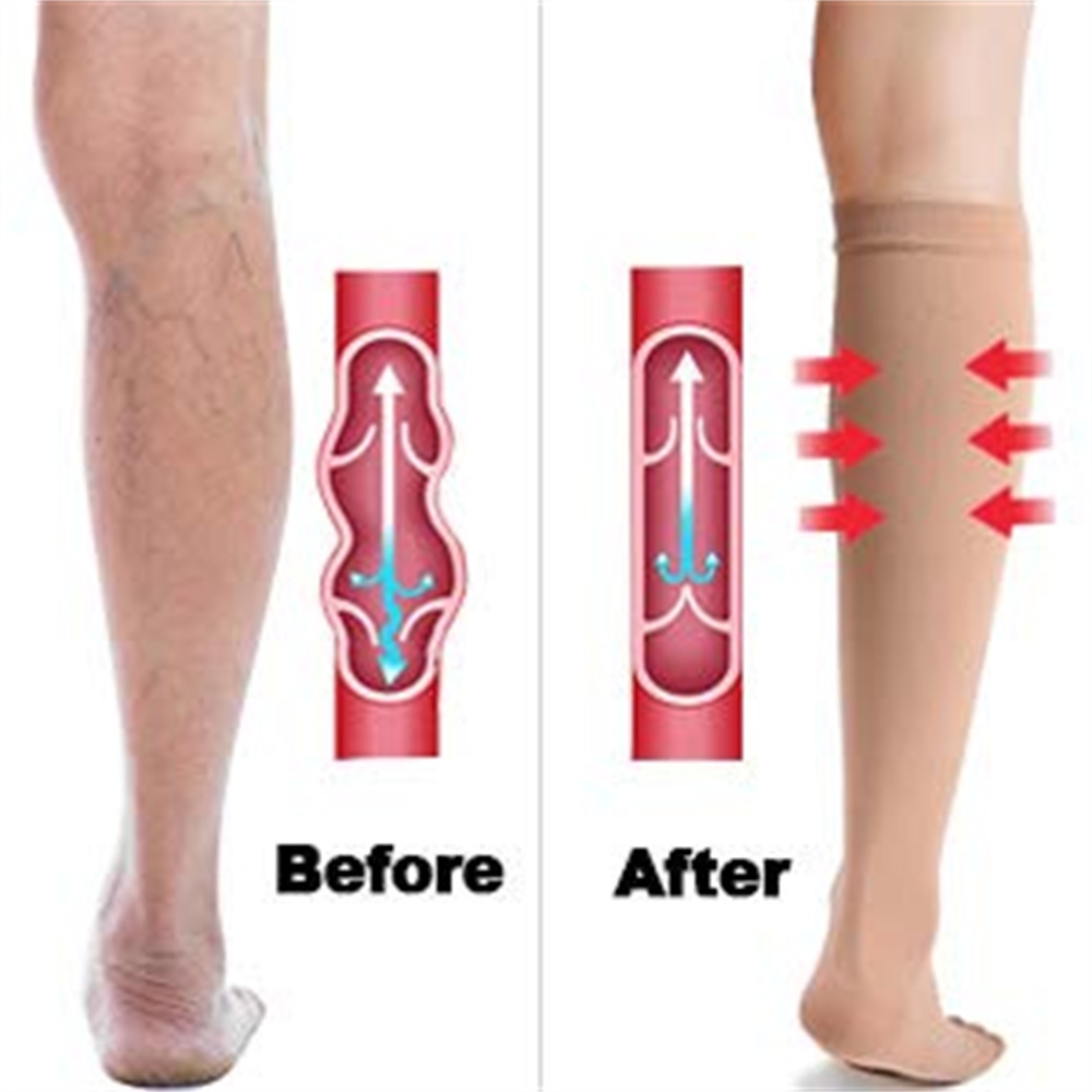 Đàn ông Phụ Nữ, Vớ Nén Thể Thao Vớ Chạy Bộ Hỗ Trợ Nylon Unisex Ngoài Trời Tĩnh Mạch Giãn Tĩnh Mạch Dài Vớ áp Lực Dài Đầu Gối Cao