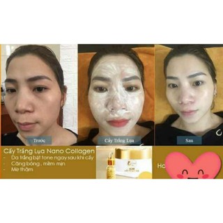 CẤY TRẮNG LỤA NANO COLLAGEN