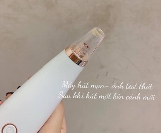 Máy hút mụn cầm tay