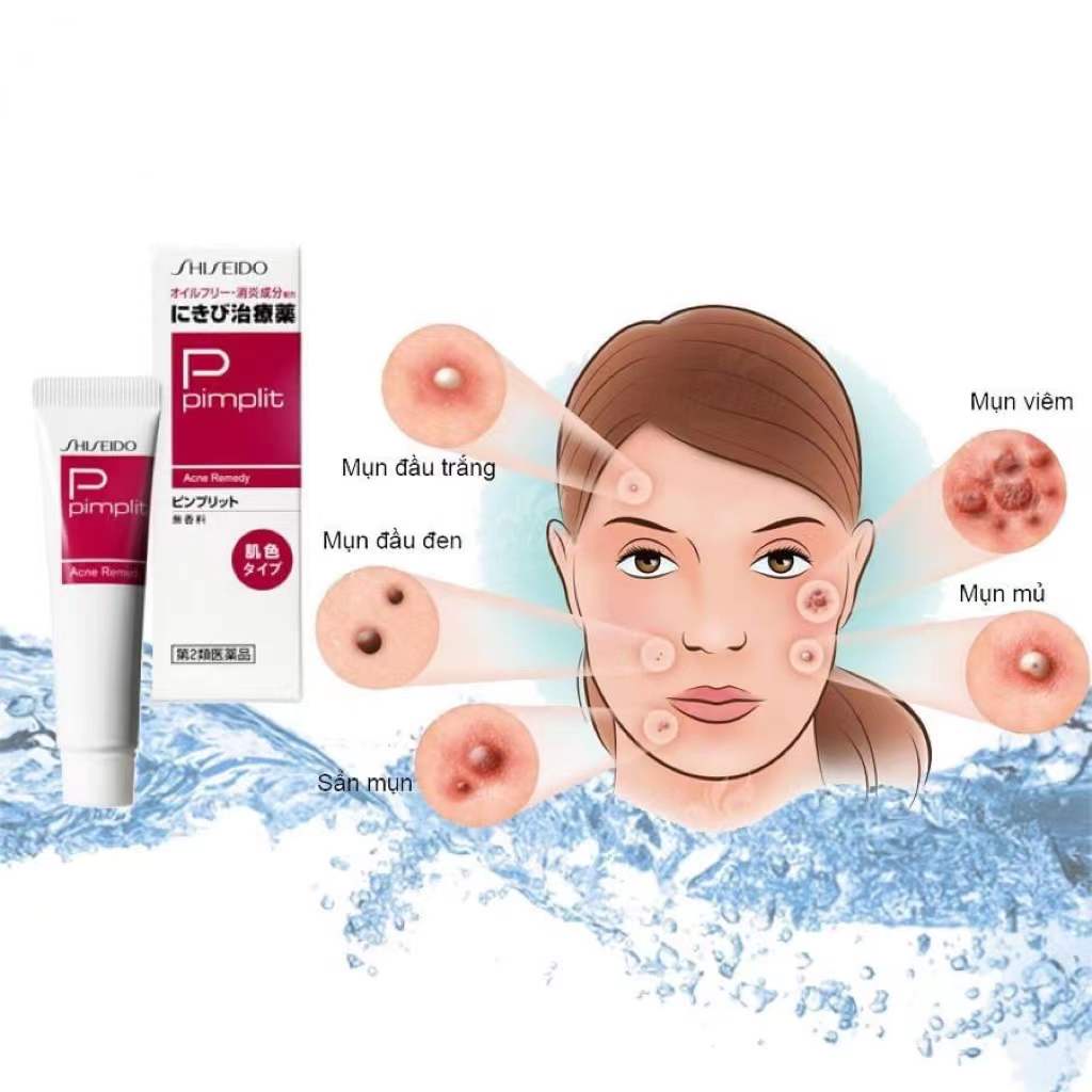 KEM LÀM GIẢM MỤN SHISEIDO PIMPLIT