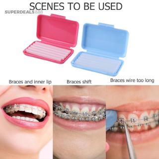 Set 5 Thanh Sáp Chỉnh Nha Chuyên Dụng Cho Niềng Răng
