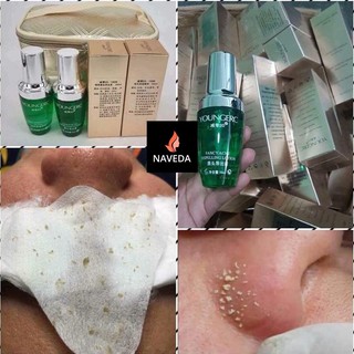 Tinh Chất Ủ Mụn Youngerc 50ml