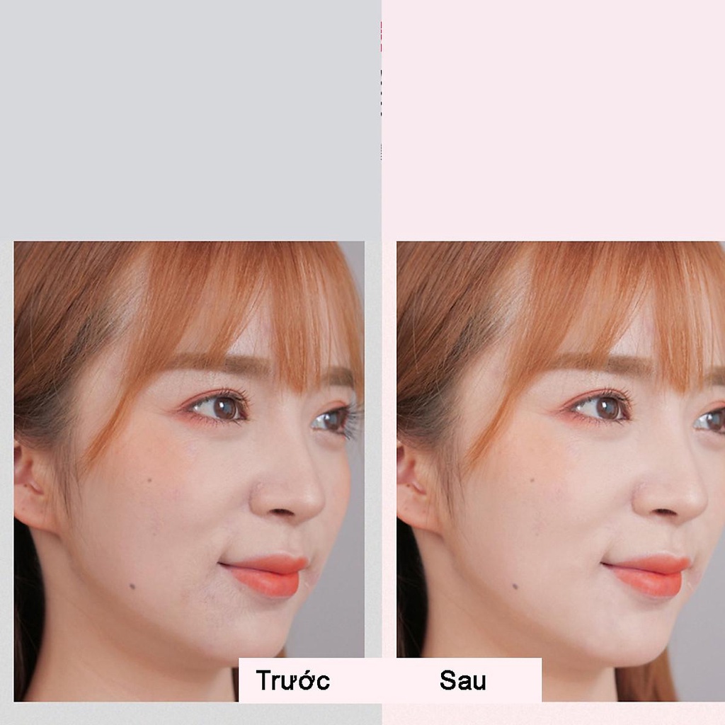 Máy se triệt lông mặt - Công cụ tẩy lông mặt hiện đại dòng cao cấp có thể dùng bằng Pin và sạc pin - SG6650