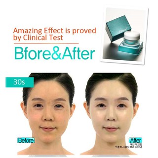 Kem Cloud-X whitening cream