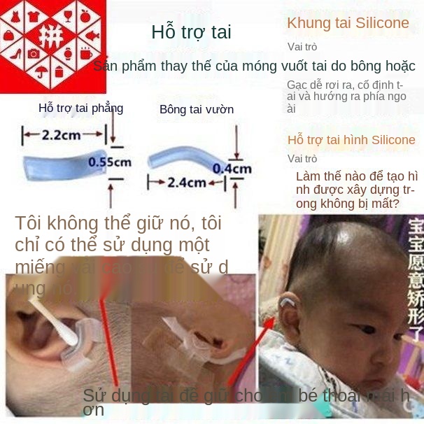 CTích hợp bộ chỉnh hình tai sau cho trẻ sơ sinh, miếng dán tai, nắn thiết bị cài đặt chống bẹt
