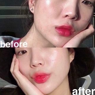 (AUTHENTIC 100%) SALE SỐC SERUM AHC