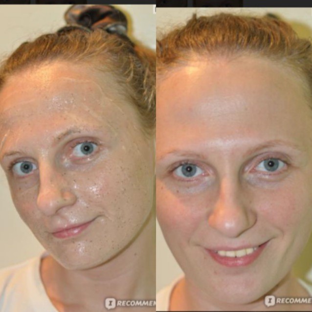 Tẩy da chết mặt Green Pharmacy cà phê và mật ong | BigBuy360 - bigbuy360.vn