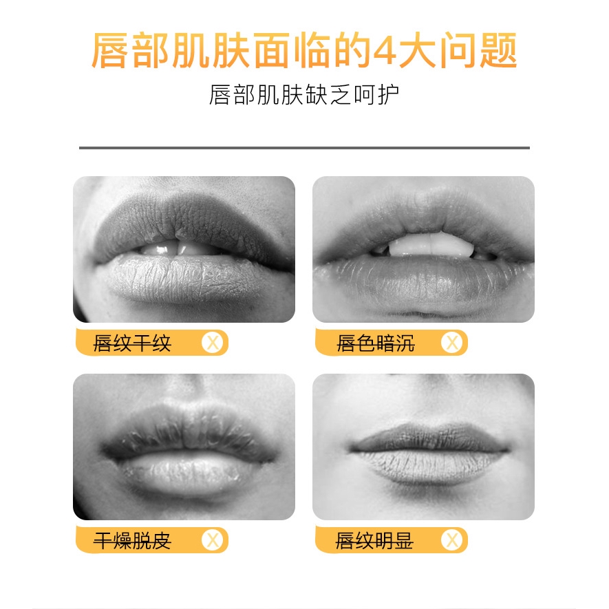(Hàng Mới Về) Mặt Nạ Môi Sữa Dưỡng Ẩm Cải Thiện Tình Trạng Môi Khô Nứt Nẻ | BigBuy360 - bigbuy360.vn