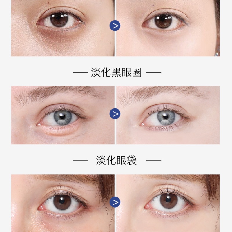 Kem dưỡng da mắt MOXIE GIRLZ chiết xuất Vitamin A cồn Massage làm săn chắc da