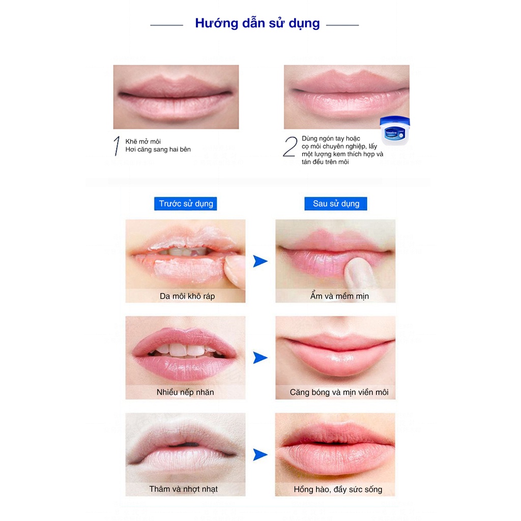Son Dưỡng Môi Vaseline Dạng Hộp Cấp Ẩm Làm Mềm Mịn Môi, 7g Original