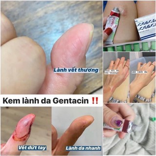 Kem sẹo Gentacin Nhật Bản