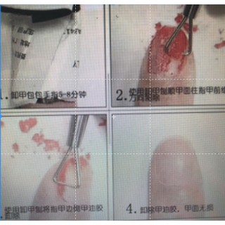 Cây cạo gel ( tháo móng gel )