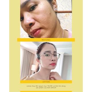 Serum phục hồi da R1 ADA Cosmetic