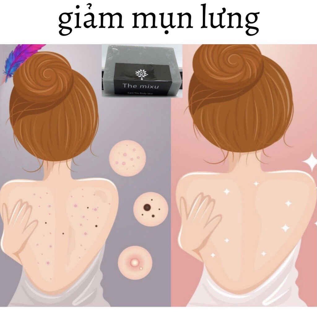 Xà phòng tắm giảm mụn lưng,mụn Ngực.mụn mông. nang lông Soap.MIXU HLOHA.handmade