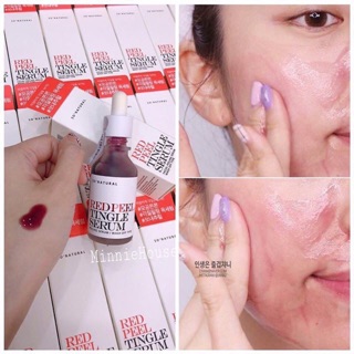 Serum tái tạo Redpeel