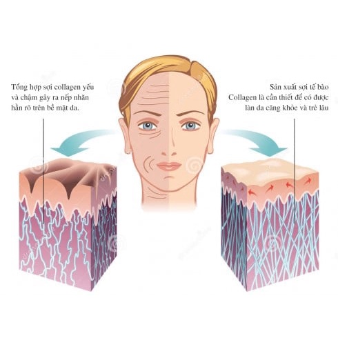 Viên dưỡng da Collagen Fresh