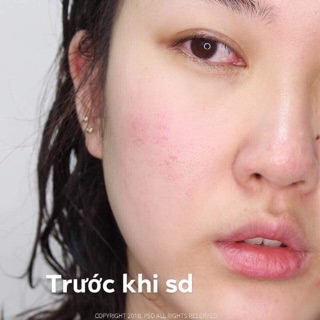 Combo 10 gói tinh chất xanh ohui