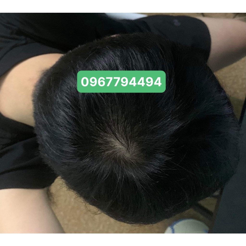 Mọc tóc Hair 4U Pro