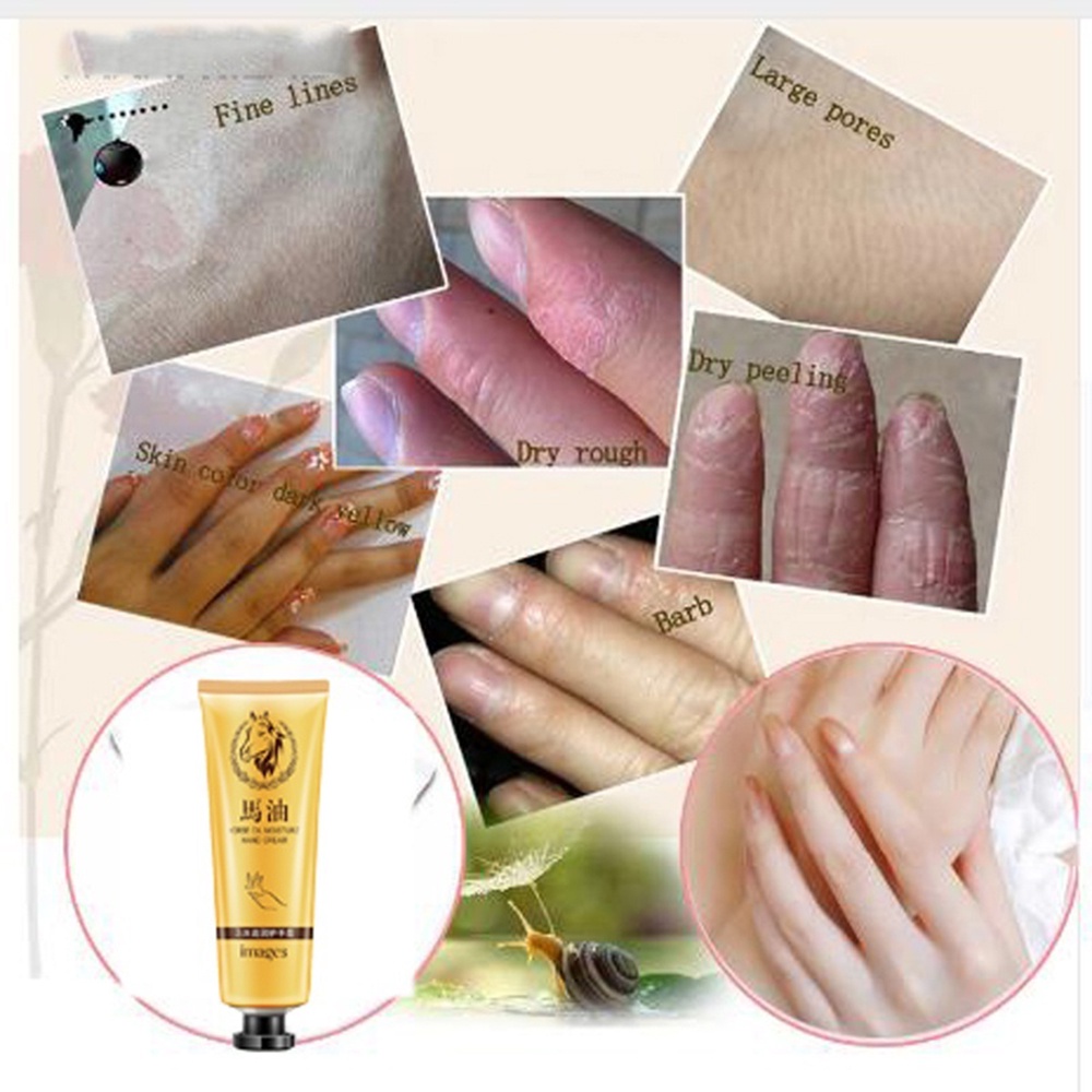 Kem Dưỡng Ẩm Làm Trắng Da Tay Và Cơ Thể 30g