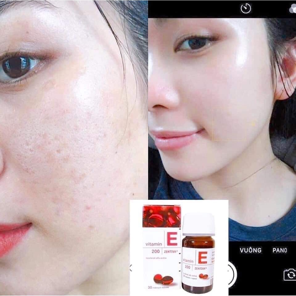 Vitamin E đỏ thủy tinh Nga 400mg  thủy tinh, đẹp da, chống lão hóa, tốt cho mắt