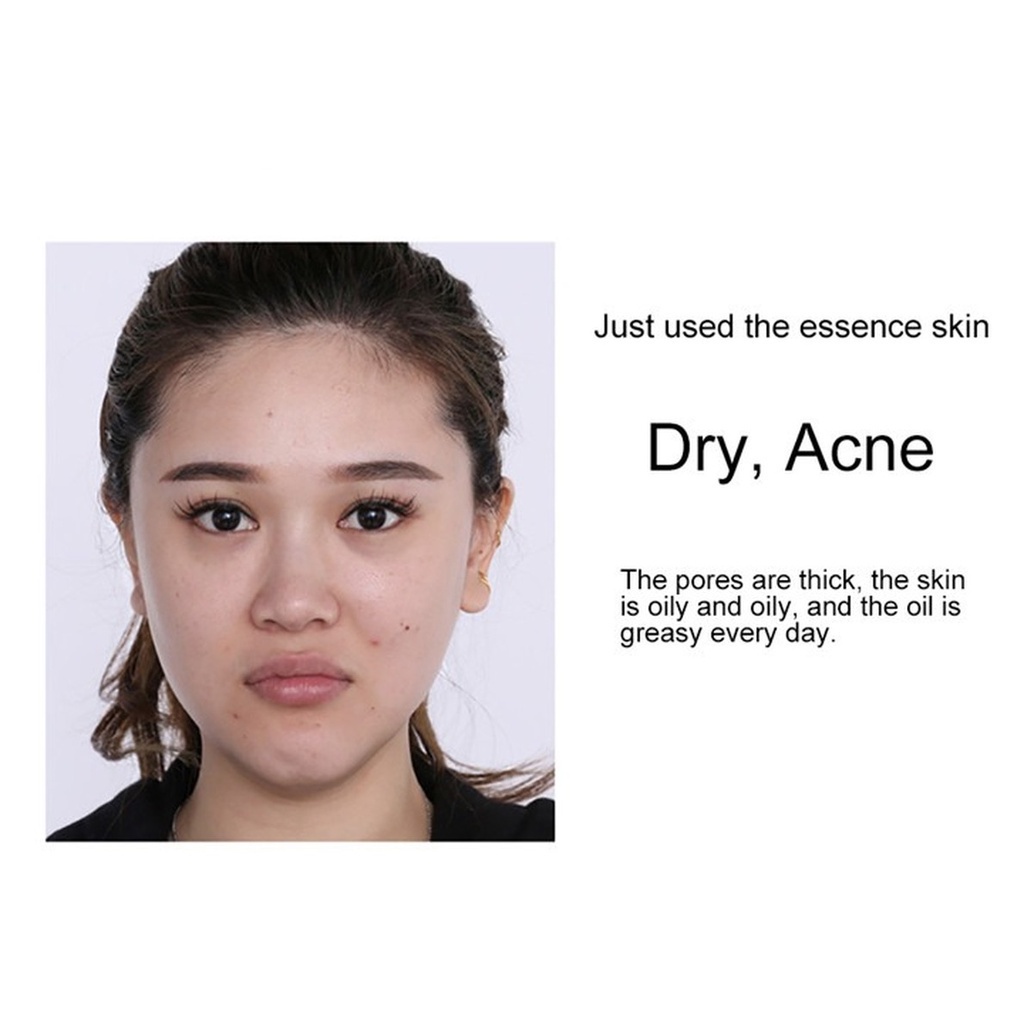 Tinh Chất Vàng 24K Hyaluronic Acid Dưỡng Ẩm Làm Trắng Da Chống Nếp Nhăn 30ml