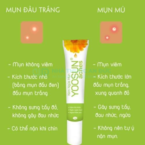 Kem Ngừa Mụn Yoosun Acnes 15g, Ngăn Ngừa Mụn Kiểm Soát Bã Nhờn, Tái Tạo Phục Hồi Da – Nhà thuốc An Đức